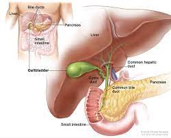 Gallbladder Problems with Gallstones: Understanding, Diagnosis, and Treatment
