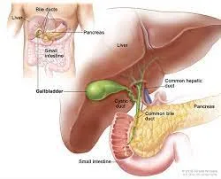  Gallbladder Problems with Gallstones: Understanding, Diagnosis, and Treatment 